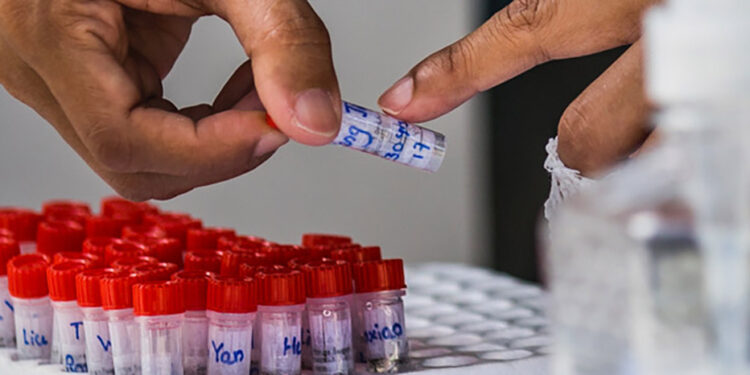A health worker checks COVID-19 swab containers in Yangon. / Htet Wai / The Irrawaddy