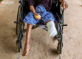 U San Hla, who lost his leg in a mine blast near Namtwe Village. / Htet Wai / The Irrawaddy
