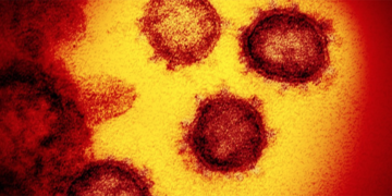 A supplied electron micrograph showing the coronavirus that causes COVID-19. / Courtesy of the US National Institute of Allergy and Infectious Diseases / Kyodo