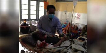 The landmine victim at Sittwe Hospital / U Than Tun